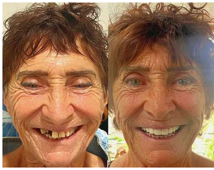 Antes y después