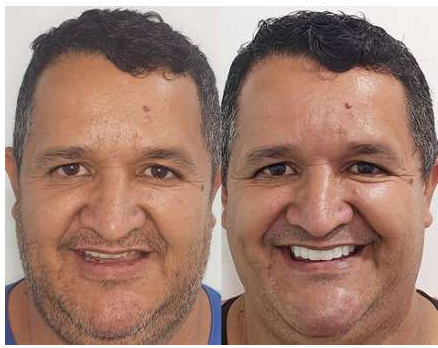 Antes y después