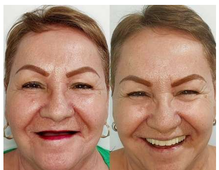 Antes y después